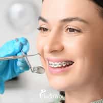 Orthodontics in Los Algodones, Mexico: A Patient's Guide to Costs, Clinic Safety, and Travel Logistics
